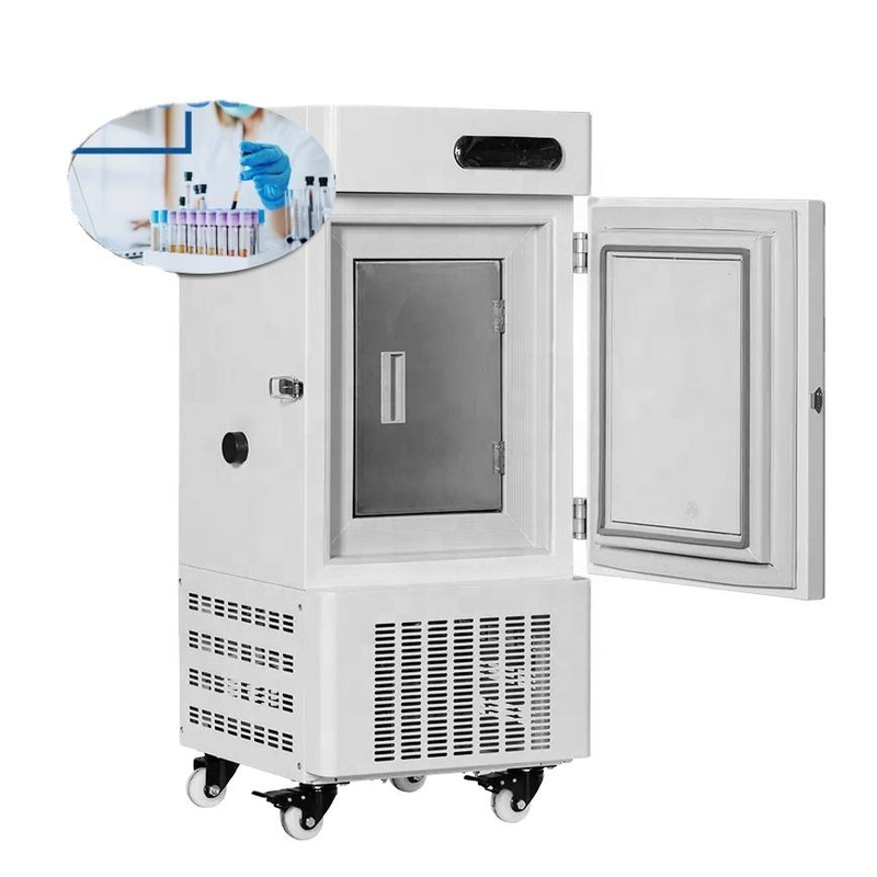 -86 Grad Mini Labor aufrecht Ultra Tiefe Temperatur Gefrierschrank